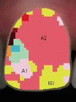 歯の色を計測した画像