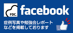 フェイスブック