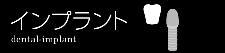 インプラント