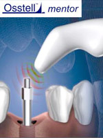 Osstell mentorインプラント体固定診断測定器